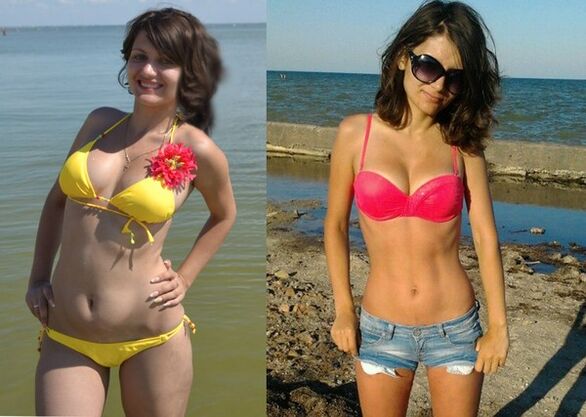 Anna kaotas NexaSlimiga 10 kg